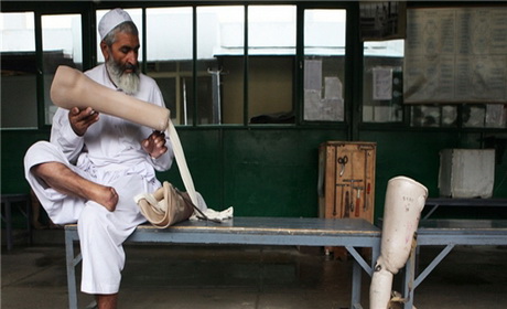 تصویر از یک داکتر افغان با اختراع دستگاهی از قطع دست و پا جلو گیری می کند