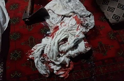تصویر از یک پسر در تخار مادرش را با تیشه کشت